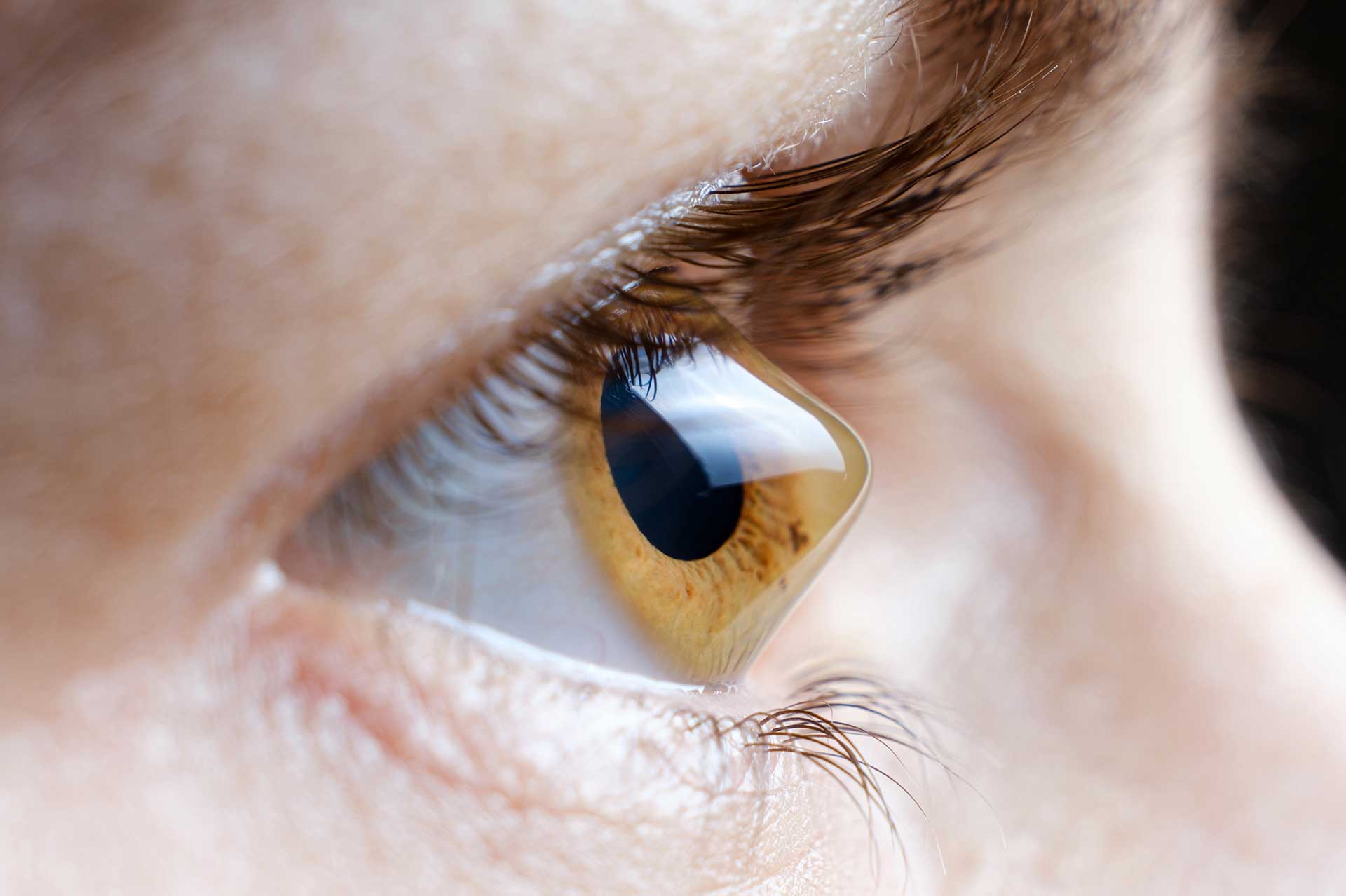 Fim Dos Óculos? Implante De Lentes Pode Deixar Visão 3 Vezes Melhor